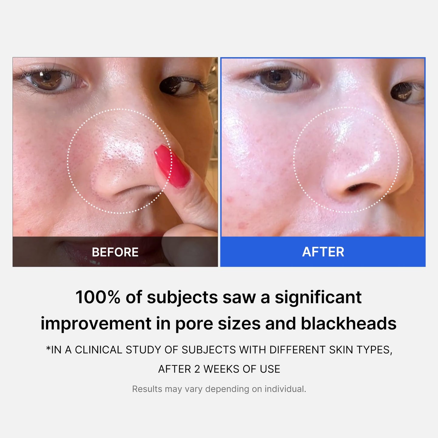 Medicube Zero Pore Pads 2.0 – Exfoliating & Pore-Care Toner Pads with AHA & BHA, Dual-Textured, 70 Pads