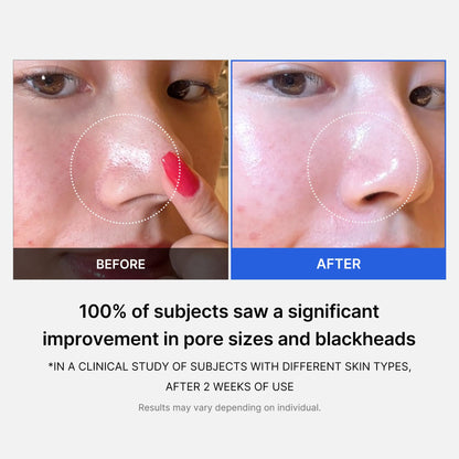 Medicube Zero Pore Pads 2.0 – Exfoliating & Pore-Care Toner Pads with AHA & BHA, Dual-Textured, 70 Pads